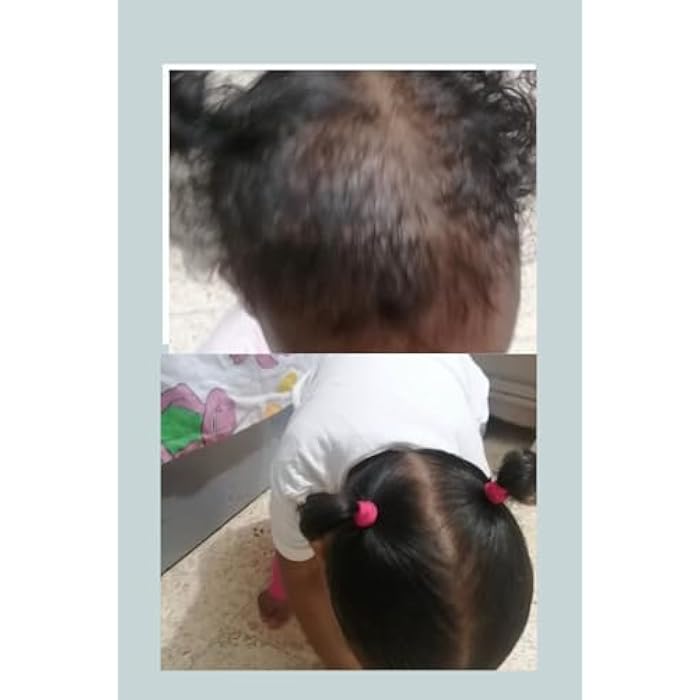 زنك اويل للشعر صحى ناعم وكثيف يحتوى عن اكثر من 7 انواع من الفيتامينات الأساسية للشعر وفروة صحية100 ملي - Image 2